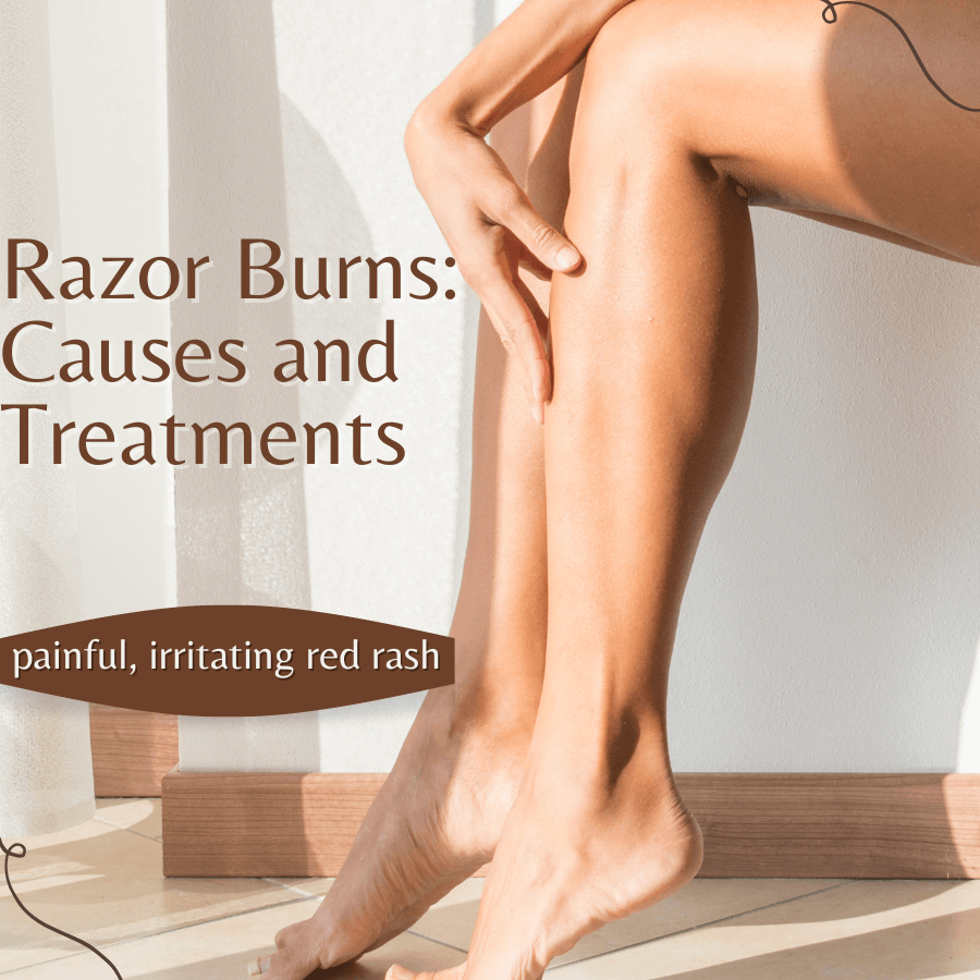 Leg Razor Burn 5 Steps to Avoid Razor Burn – Pure Native CBD